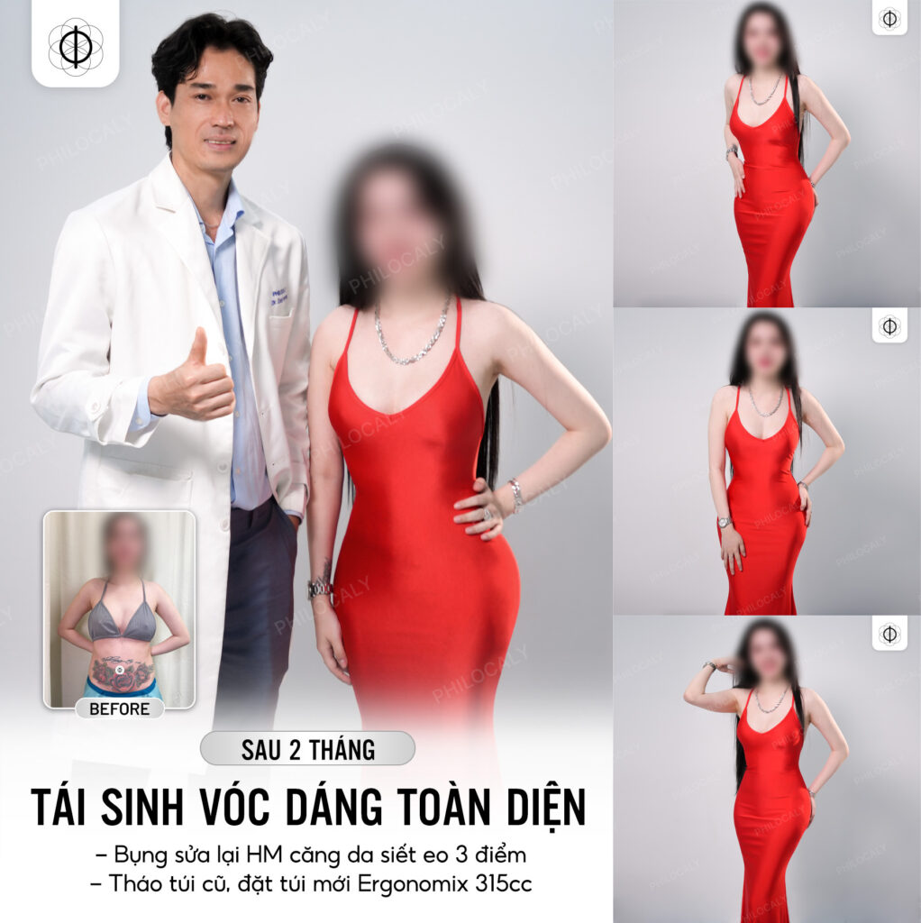 Combo hút mỡ căng da siết eo 3 điểm từ bàn tay bác sĩ Huỳnh Tấn Đạt